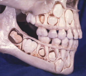 childsskull1.jpg