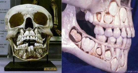 childsskull2.jpg