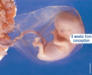 conception8wks.jpg