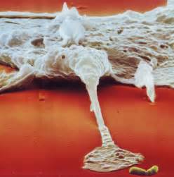 macrophage.jpg