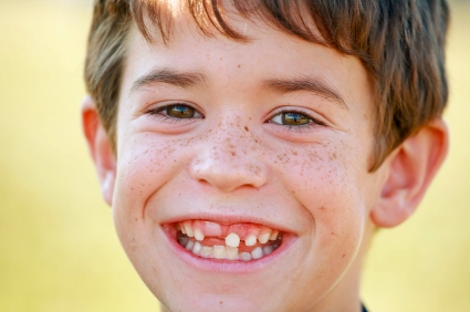 teethlost1.jpg