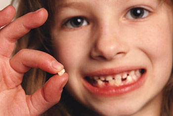 teethlost2.jpg
